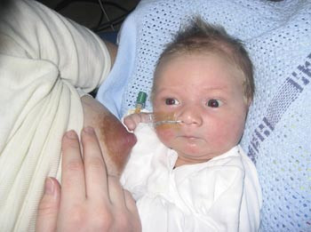 Figur 2  Nyf&oslash;dte med &aring;pne, klare &oslash;yne ble ammet lenger enn dem med pussfylte &oslash;yne. Foto privat, gjengitt med tillatelse fra&hellip;