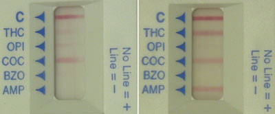 Figur 2  Eksempel p&aring; avlesning av hurtigtest. To hurtigtester som er avlest av to personer uavhengig av hverandre. C =&hellip;