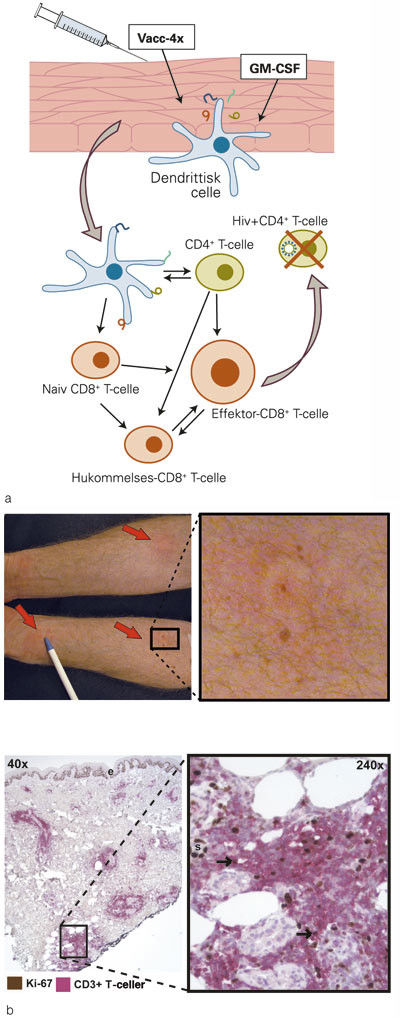 Figur 3  Studier med terapeutisk immunisering ved kronisk hivinfeksjon ved Ullev&aring;l universitetssykehus i samarbeid med&hellip;
