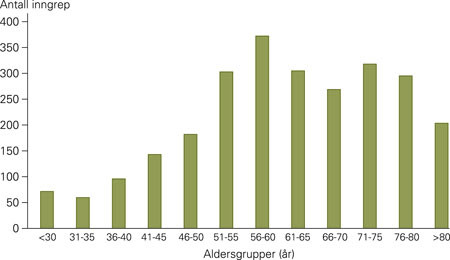 Antall operasjoner p&aring; parathyreoidea i perioden fordelt p&aring; aldersgrupper