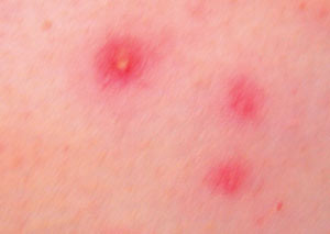 Figur 3  Enkeltelementer hos F