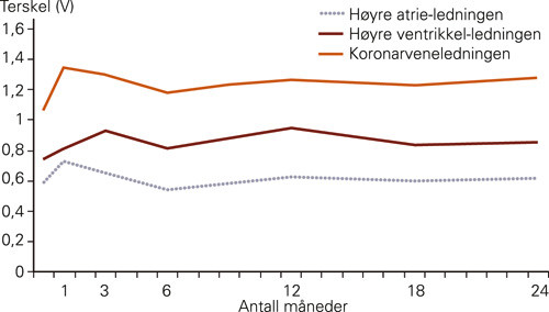 Figur 2  Terskelverdier for stimulering m&aring;lt ved 0,5 ms impulsvarighet