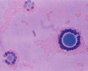 Figur 2  Mycoplasmakolonier (bl&aring;) inkubert med en suspensjon av humane r&oslash;de blodceller farget med 0,1 % metylenbl&aring;tt. Bildet&hellip;