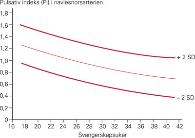 Figur 2 Normalkurve for pulsatilitetsindeks (PI) i a. umbilicalis i forhold til svangerskapets varighet. PI er normal dersom&hellip;