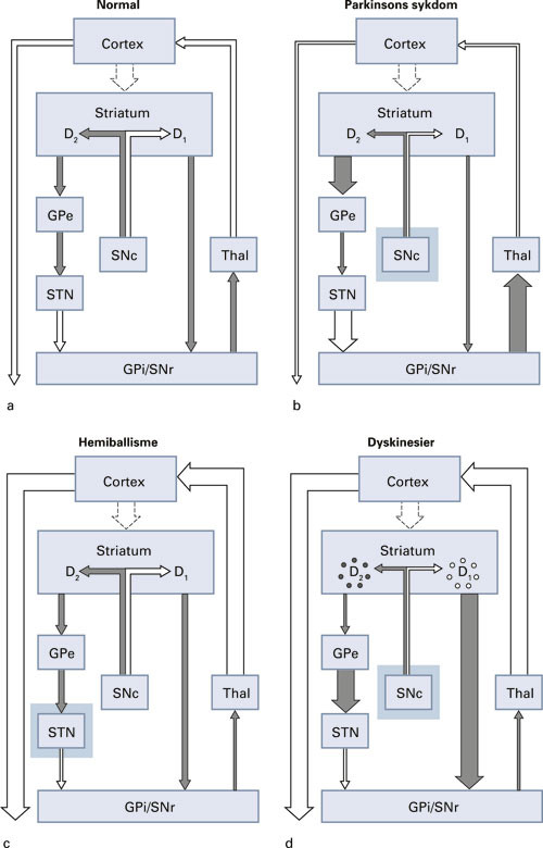Figur 3  Modell som viser forbindelsene mellom basalgangliene, thalamus og motoriske barkomr&aring;der. Inhibitoriske (GABAerge)&hellip;