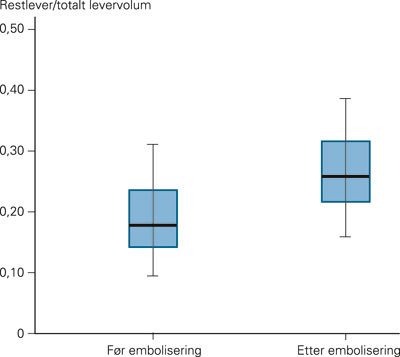 Figur 3  Effekt av portveneembolisering p&aring; fraksjonen restlever/totalt levervolum. Statistisk signifikant &oslash;kning av&hellip;