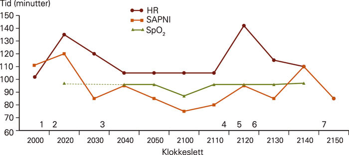 Figur 2 Hjertefrekvensverdier (HR), ikke-invasivt systolisk blodtrykk (SAPNI) og perifer transkutan oksygenmetning (SpO₂)&hellip;