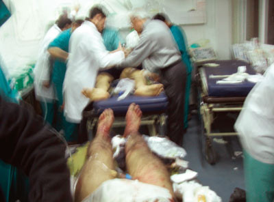 Mottak av bombeskadede