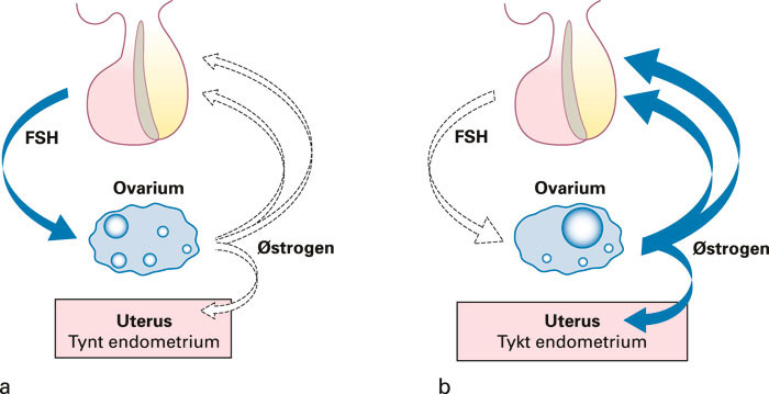 Figur 2  Letrozol blokkerer aromatase, et enzym som i eggstokkene katalyserer danningen av &oslash;strogener fra androgener. Man&hellip;
