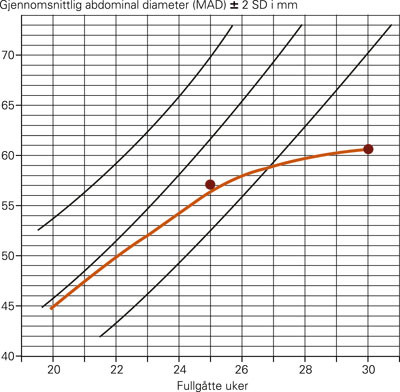 Figur 2  Fosterets abdominale tilvekst i forhold til svangerskapslengden