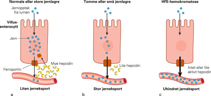 Figur 3  Jernopptak i enterocytter og eksport til plasma. a) Normal absorpsjon; ved normal jernstatus produseres mye&hellip;