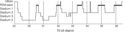 Figur 2  Fysiologisk fordeling av s&oslash;vnstadier i l&oslash;pet av natten. REM-s&oslash;vnen er markert med r&oslash;dt