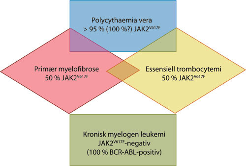 Figur 2  Skjematisk fremstilling av de viktigste myeloproliferative sykdommer og prosentvis angivelse av positiv JAK2V617F&hellip;