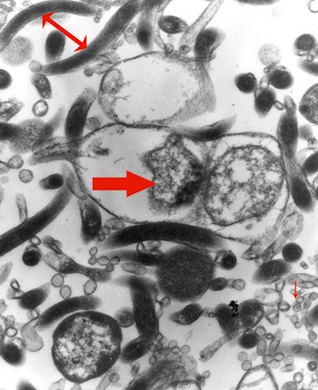 Figur 3  Borrelia burgdorfer-cyster fra destillert vann som er overf&oslash;rt til BSK-H-medium og dyrket to uker ved 33 &deg;C&hellip;
