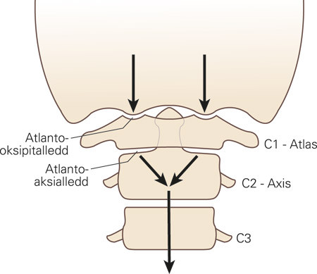 Figur 1 Skjematisk fremstilling av belastningens C2-sentralisering i omr&aring;det mellom oksipitalkondylene, C1 og C3