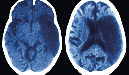 Illustrasjonsfoto. &copy; Science Photo library