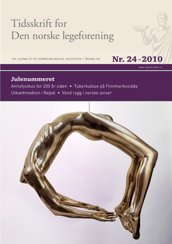 Louise Bourgeois. Arch of hysteria, 1993. Polert, patinert bronse. Hengende. 83,8 &times; 101,6 &times; 58,4 cm. Cheim & Read and Hauser&hellip;