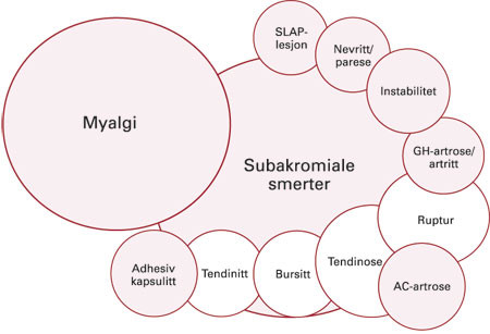 Figur 1  Skjematisk fremstilling for hvordan ulike tilstander i skulderen overlapper og kan gi subakromiale smerter &hellip;