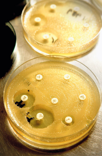 Sykdommer som tuberkulose er p&aring; fremmarsj p&aring; grunn av resistens mot antibiotika. Illustrasjonsfoto SCANPIX