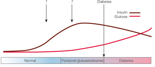 Figur 1  To stadier p&aring; veien til diagnose av type 2-diabetes, kroppens produksjon av insulin og glukose i blodet er under&hellip;