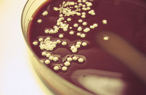 Figur 2  Dyrking av abscessmateriale med eleverte, hvite kolonier i renkultur p&aring; blodagarsk&aring;l inkubert under aerobe forhold