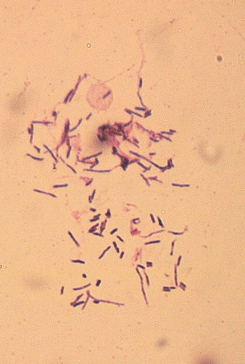 Figur 3  Mikroskopi av grampreparat viser lange, slanke grampositive staver