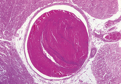 Illustrasjonsfoto Sciencephoto/SCANPIX