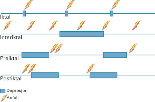 Figur 1  Tidsmessig relasjon mellom epileptiske anfall og psykiatriske symptomer