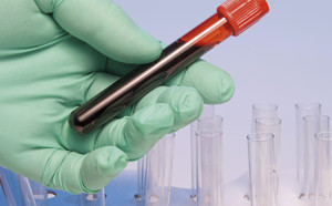 Illustrasjonsfoto Istockphoto