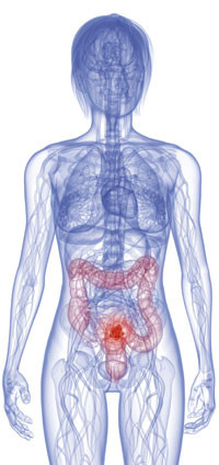 Illustrasjonsfoto Istockphoto