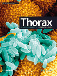 Artikkelen ble 8.6. 2011 publisert p&aring; nett og omtalt i en lederartikkel i tidsskriftet Thorax (http://thorax.bmj.com).