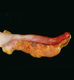 Illustrasjonsfoto SCANPIX/Sciencephoto