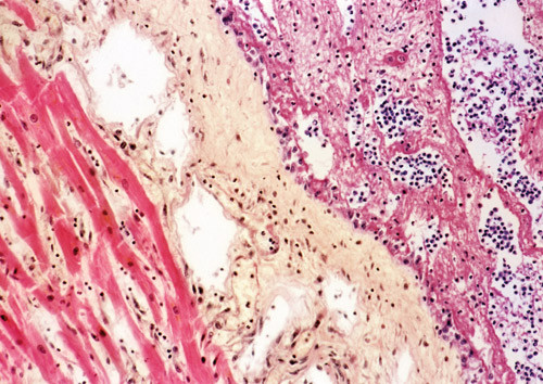 Illustrasjonsfoto SCANPIX/Sciencephoto