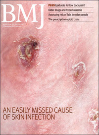 Artikkelen ble publisert 13.9. 2011 i BMJ (www.bmj.com), som regnes som en av de &laquo;fem store&raquo; innen medisinsk publisering,&hellip;