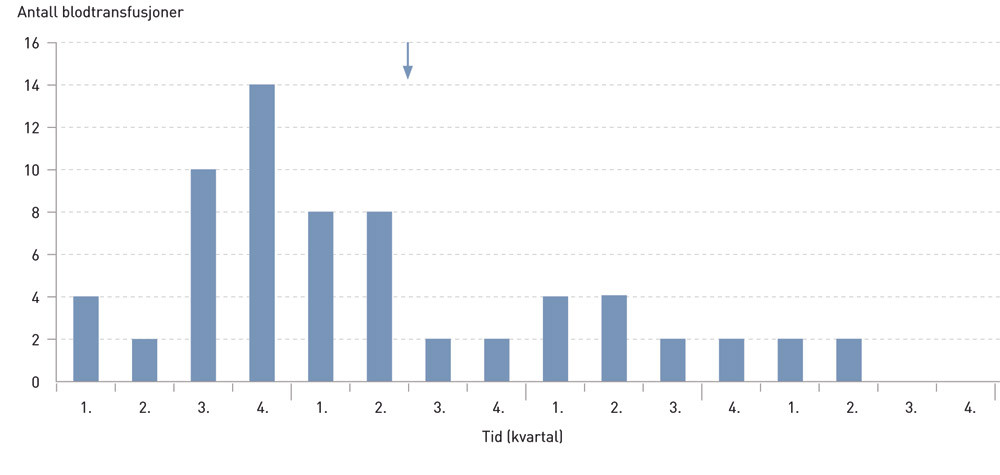 Figur 1  Antall blodtransfusjoner per kvartal f&oslash;r og etter oppstart med somatostatinanalog (pil). F&oslash;r behandling varierte&hellip;