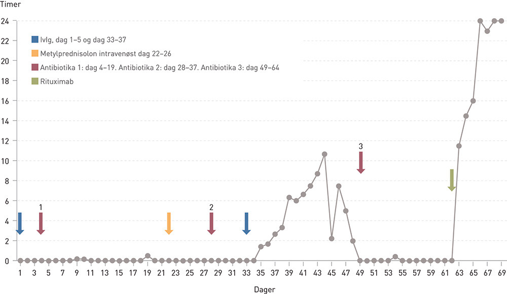 Figur 1  Antall timer uten respiratorst&oslash;tte per d&oslash;gn hos en mann i 70-&aring;rene med myastenisk krise