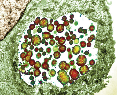 Klamydiabakterien inne i en celle. Foto Science Photo Library/Scanpix