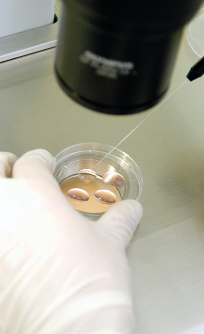 Illustrasjonsfoto Sciencephoto/NTB scanpix