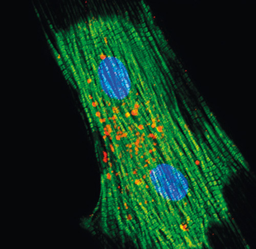 Illustrasjonsfoto Sciencephoto/NTB Scanpix