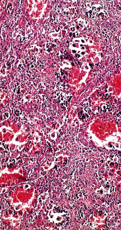 Science Photo Library/NTB Scanpix