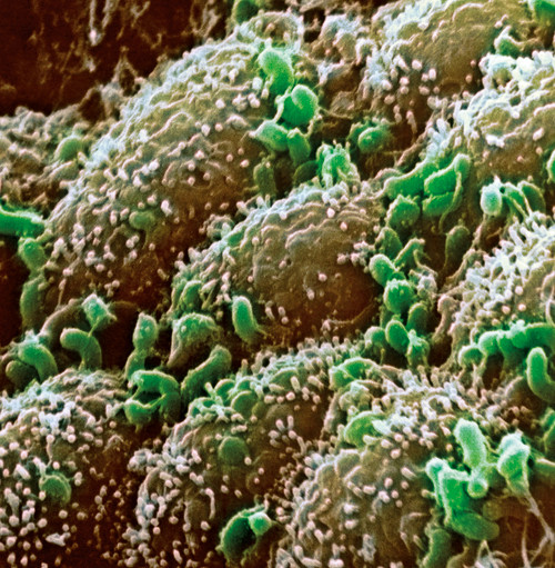 Illustrasjonsfoto Science Photo Library/NTB scanpix