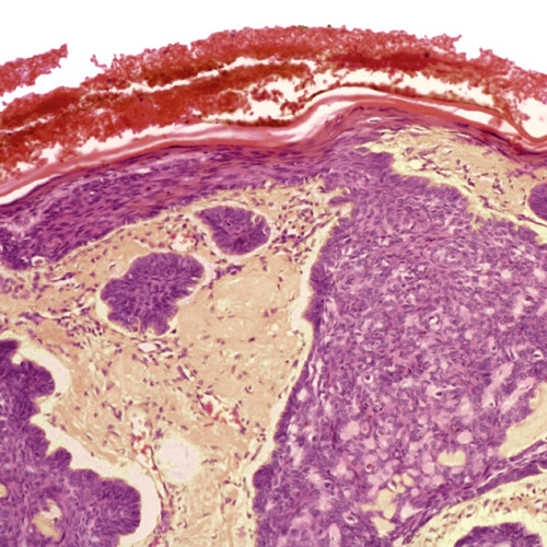 Illustrasjonsfoto Science Photo Library/NTB scanpix