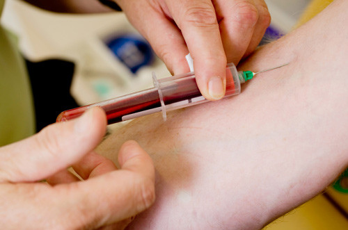 Illustrasjonsfoto Science Photo Library/NTB scanpix