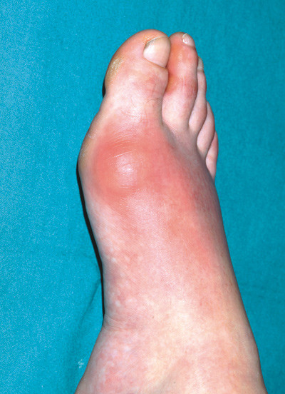 Illustrasjonsfoto Science Photo Library/NTB scanpix