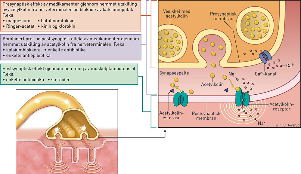 Figur 2  Den nevromuskul&aelig;re synapse. Depolarisering av den presynaptiske membran frigj&oslash;r acetylkolin, som aktiverer&hellip;