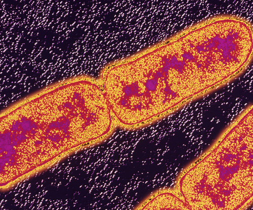 Illustrasjonsfoto Science Photo Library/NTB scanpix