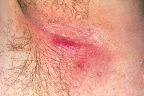 Illustrasjonsfoto Science Photo/NTB scanpix