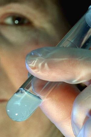 Illustrasjonsfoto Tom-Egil Jensen/NTB scanpix