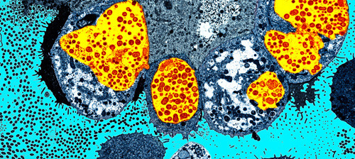 Klamydiainfeksjon i eggleder. Transmisjonselektronmikroskopisk bilde. Foto Science Photo Library/NTB scanpix
