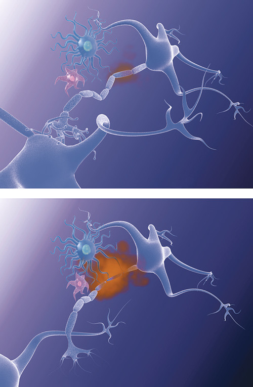 Science Photo Library/NTB scanpix